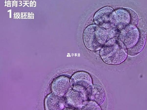 一級胚胎不建議養囊