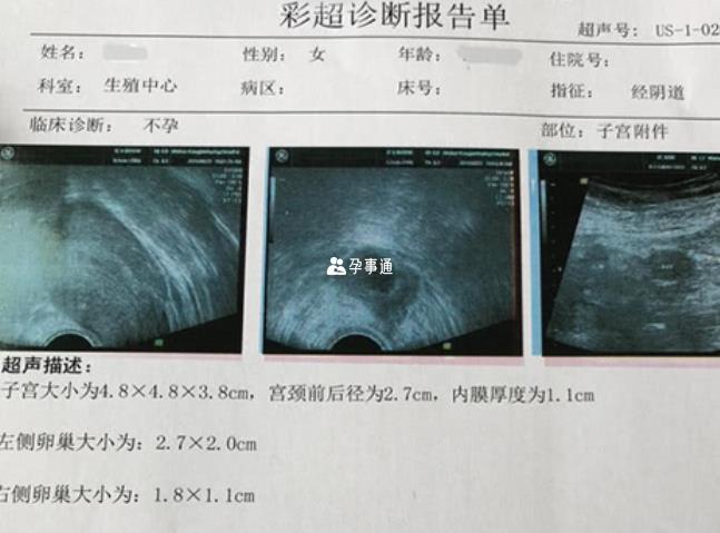amh檢查和彩超診斷報告結果