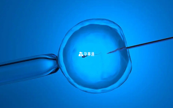 試管嬰兒技術