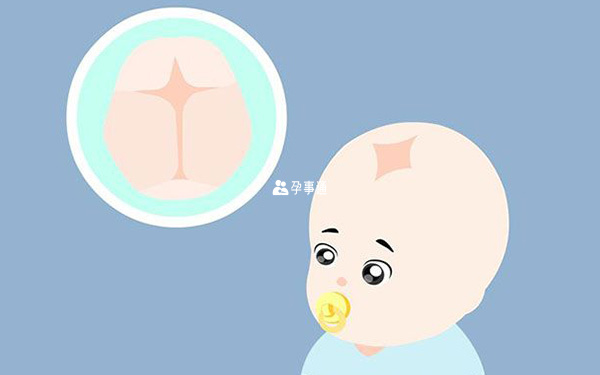 顱縫早閉
