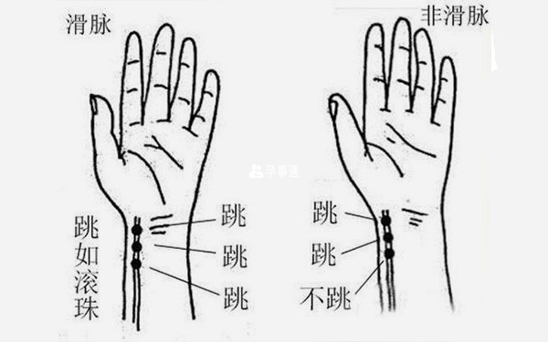 滑脈是什麼樣的圖解
