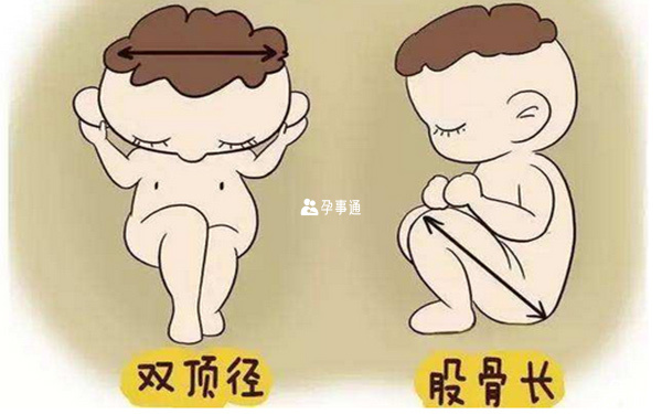 股骨長和雙頂徑長度
