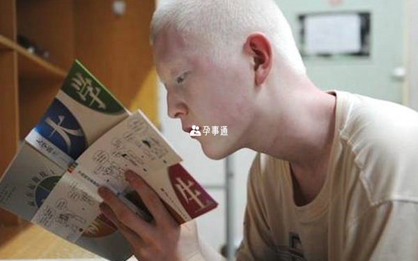 白化病