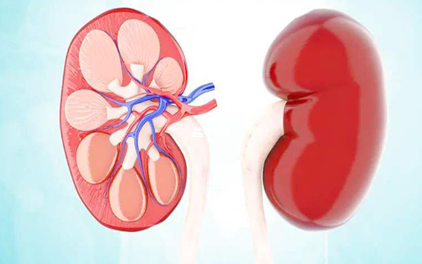 遺傳性腎病怎麼治療