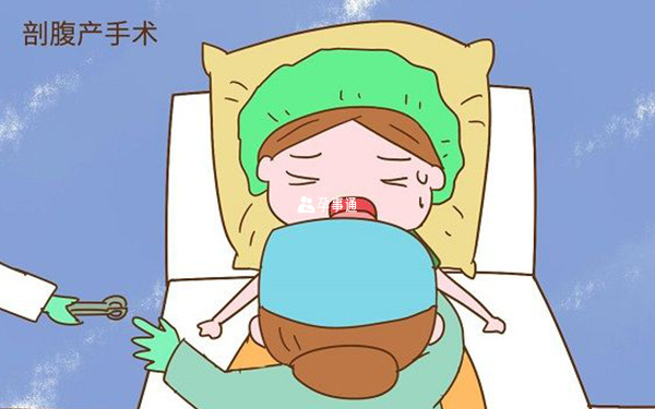 剖腹產女性
