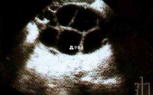 卵泡監測
