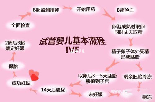 俄羅斯第一代試管嬰兒流程圖