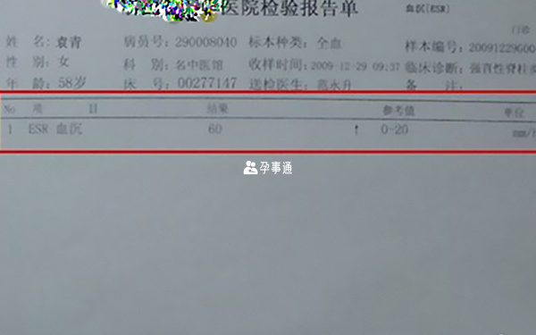 血沉正常值