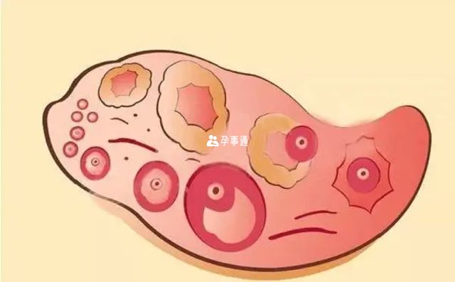 促卵泡生成激素的作用