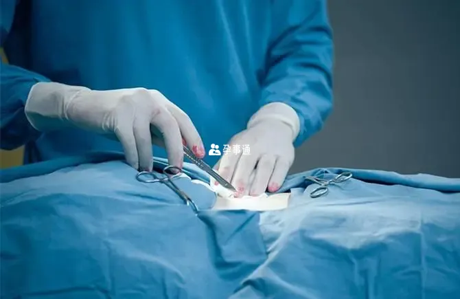 輸卵管復通手術費用明細