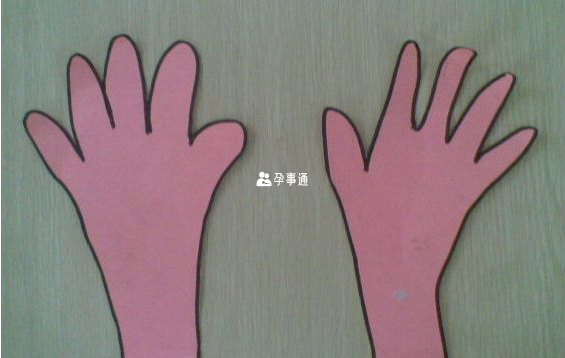 TRPS II患者的主要症狀為骨骼發育畸形