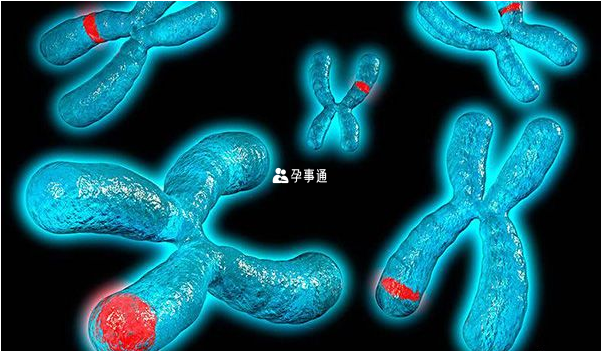 8號染色體長臂缺失誘發II型毛髮-鼻-指(趾)綜合徵