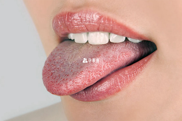 懷孕的女性在舌象上有所顯示
