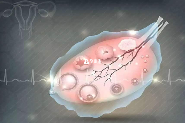 多囊卵巢的患者就可以通過促排卵來助孕