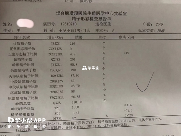 通過精液檢查能知曉精子是否異常