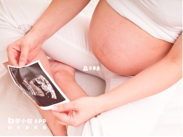開放性脊柱裂是胎兒畸形的一種