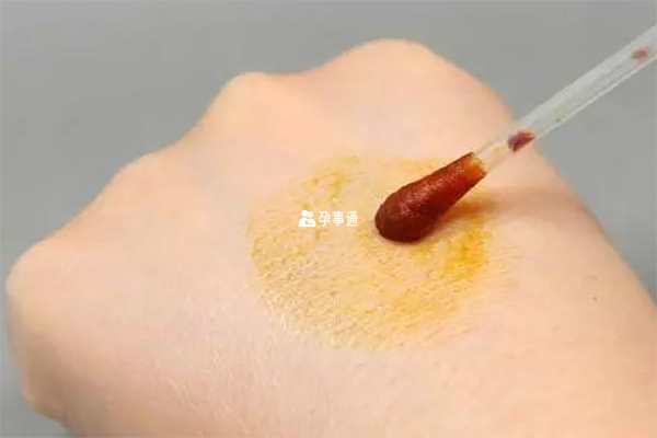 嬰兒是可以用碘伏消毒臍帶的