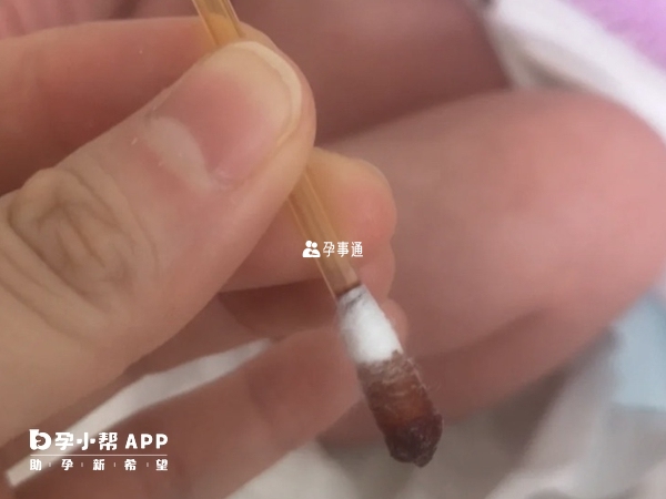 碘伏濃度高了就不能用於臍帶消毒