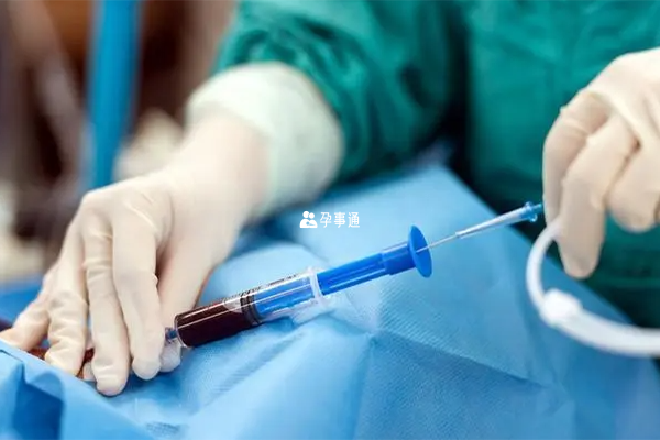 孕16-20周可做羊水穿刺