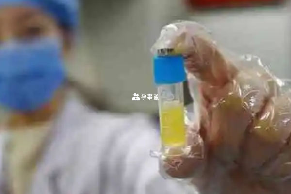 患者的體質會影響成功率