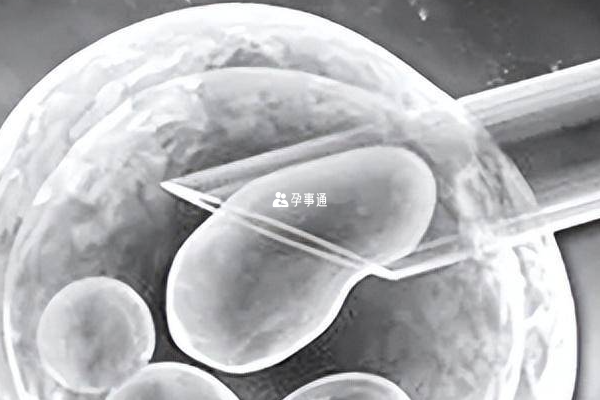 江蘇供卵試管醫院名單