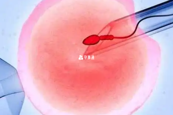 蘇州三代試管養囊成功率高嗎？