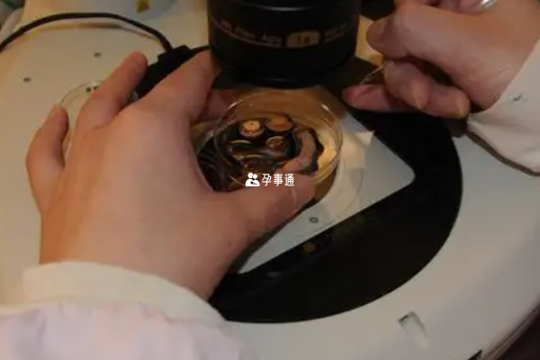 麗水人民醫院龍鳳胎試管成功率解析