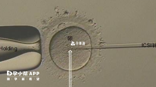 取卵17天可以同房