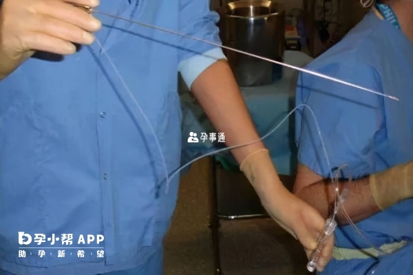 取卵後肚子痛是正常的