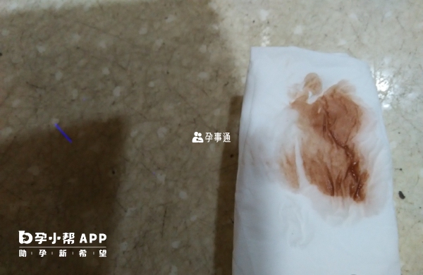 著床出血量很少