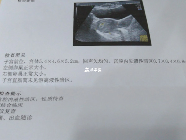 B超醫生不能告訴孕婦胎兒的性別