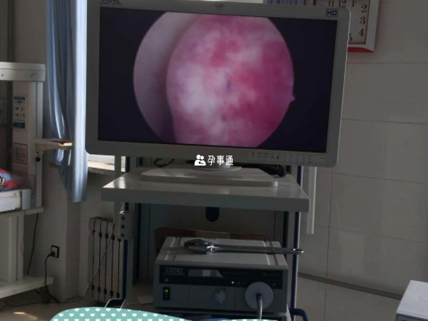 宮腔鏡電切術有什麼危害