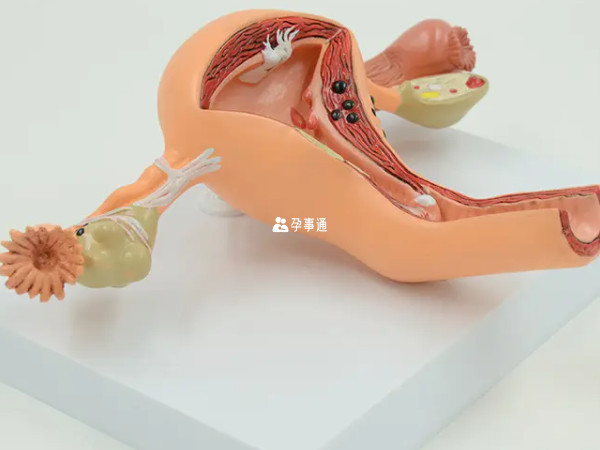 宮頸息肉摘除術有什麼風險