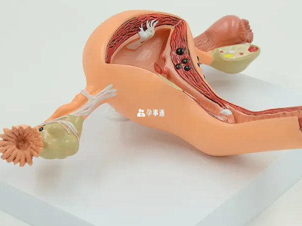 內膜檢查