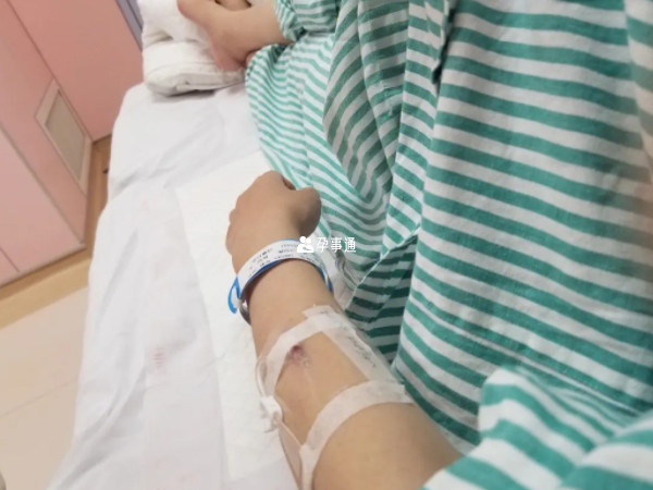 OCT試驗就是掛低劑量的催產素然後監測寶寶胎心變化情況
