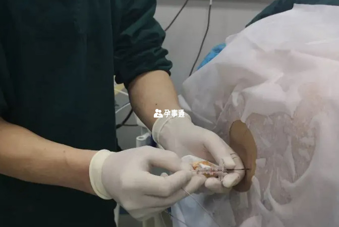 北醫三院的醫生會建議滿39周後進行剖腹產