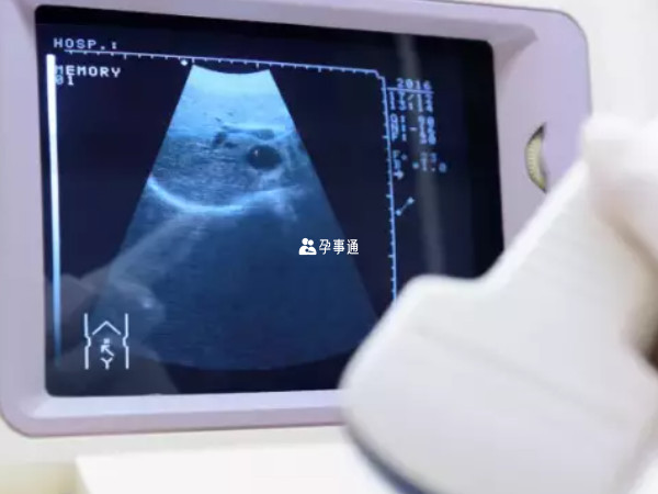 B超男孩可能生女孩