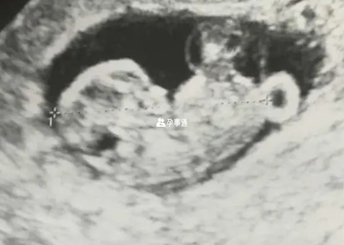 22周彩超有可能女翻男