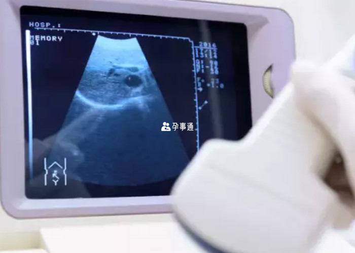39周做B超查胎兒性別可能出錯