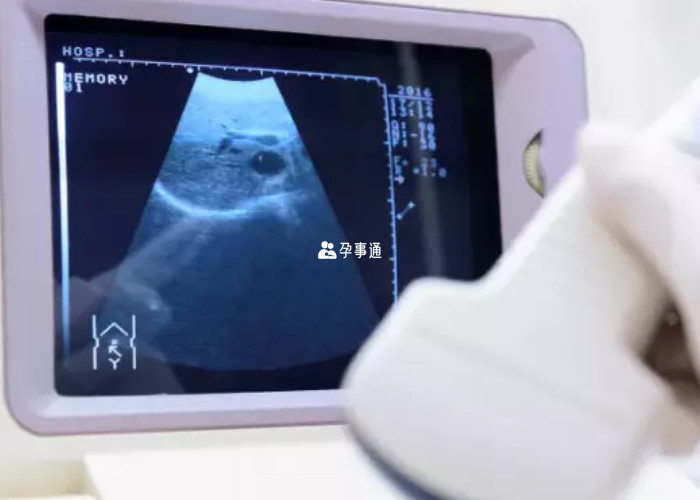 懷孕14周男孩可能生女孩