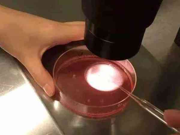試管嬰兒缺陷兒機率高不高
